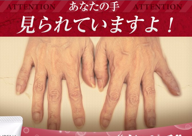 手の甲の血管に悩むイメージ