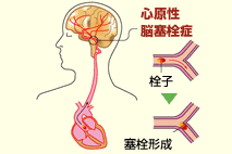 リハビリで弾こう